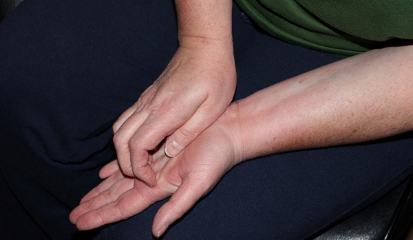 Фото – 10 Зуд на коже рук может быть психосоматической реакцией, а не физиологической