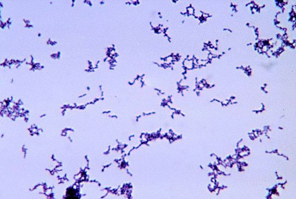 Фото 28 - Пропионовые бактерии