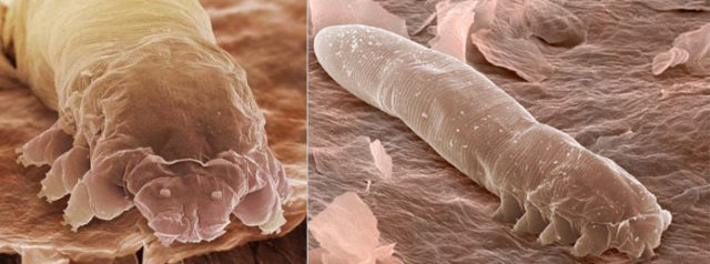 Клещ (червь) размерами 0,1-0,4 мм обитает в основании волосяного фолликула человека и млекопитающих